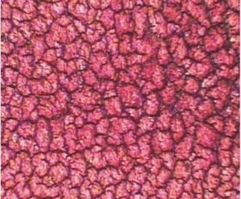 Dry Blood Observations